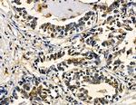 ZNF7 Antibody in Immunohistochemistry (Paraffin) (IHC (P))