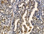 ZNF7 Antibody in Immunohistochemistry (Paraffin) (IHC (P))