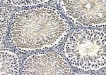ZNF7 Antibody in Immunohistochemistry (Paraffin) (IHC (P))
