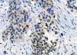 CD52 Antibody in Immunohistochemistry (Paraffin) (IHC (P))