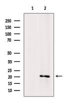 CD52 Antibody in Western Blot (WB)