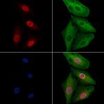 MSX1/MSX2 Polyclonal Antibody