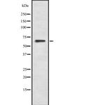 Herpes Simplex Virus Type 7 (strain JI) Antibody in Western Blot (WB)