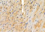 SNRPD3 Polyclonal Antibody