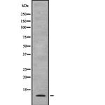 SUPT4H1 Antibody in Western Blot (WB)