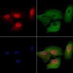 SERF2 Polyclonal Antibody