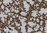TMPRSS15 Polyclonal Antibody