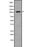 TMPRSS15 Antibody in Western Blot (WB)