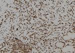 BNC1 Polyclonal Antibody