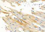 WT1-AS Antibody in Immunohistochemistry (Paraffin) (IHC (P))