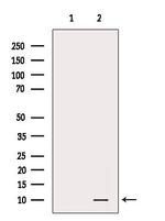WT1-AS Antibody in Western Blot (WB)
