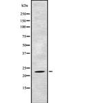 TAF10 Polyclonal Antibody