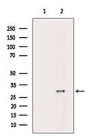 HNRNPA0 Polyclonal Antibody