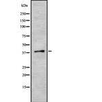 SRSF6 Polyclonal Antibody