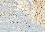 DMP1 Polyclonal Antibody
