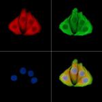 TAL2 Polyclonal Antibody