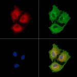LRRK1 Polyclonal Antibody
