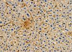 LRRK1 Antibody in Immunohistochemistry (Paraffin) (IHC (P))