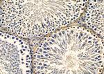 LRRK1 Antibody in Immunohistochemistry (Paraffin) (IHC (P))