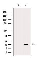 CT83 Polyclonal Antibody