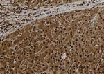 CT47 Polyclonal Antibody