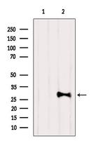 CT47 Antibody in Western Blot (WB)
