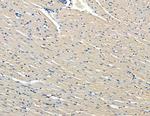 FAM111B Antibody in Immunohistochemistry (Paraffin) (IHC (P))