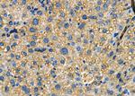 MAP3K15 Polyclonal Antibody