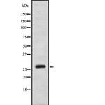 MOB2 Polyclonal Antibody