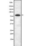 BRSK2 Polyclonal Antibody