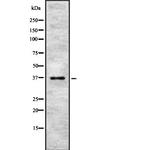 PINX1 Polyclonal Antibody