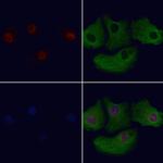 ZNF496 Polyclonal Antibody