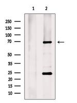 ZNF496 Antibody in Western Blot (WB)