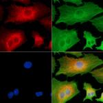 TPD52L3 Polyclonal Antibody