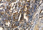 TPD52L3 Antibody in Immunohistochemistry (Paraffin) (IHC (P))