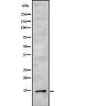 TPD52L3 Antibody in Western Blot (WB)