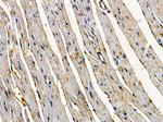 ARHGEF17 Polyclonal Antibody