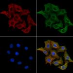 AKAP9 Polyclonal Antibody