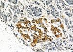 AKAP9 Antibody in Immunohistochemistry (Paraffin) (IHC (P))