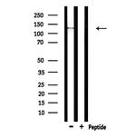 SPZ1 Antibody in Western Blot (WB)