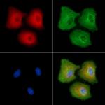 PCDH11X/PCDH11Y Antibody in Immunocytochemistry (ICC/IF)
