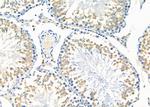 C19orf61 Antibody in Immunohistochemistry (Paraffin) (IHC (P))