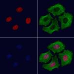 CBX8 Polyclonal Antibody