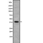 MBIP Polyclonal Antibody