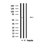 RBPJL Polyclonal Antibody