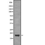 CGGBP1 Polyclonal Antibody