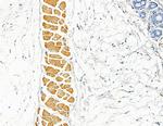 AKAP11 Antibody in Immunohistochemistry (Paraffin) (IHC (P))