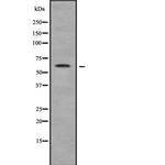 TRIM35 Polyclonal Antibody