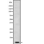 PKIG Polyclonal Antibody