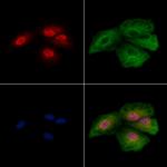 THRAP3 Polyclonal Antibody